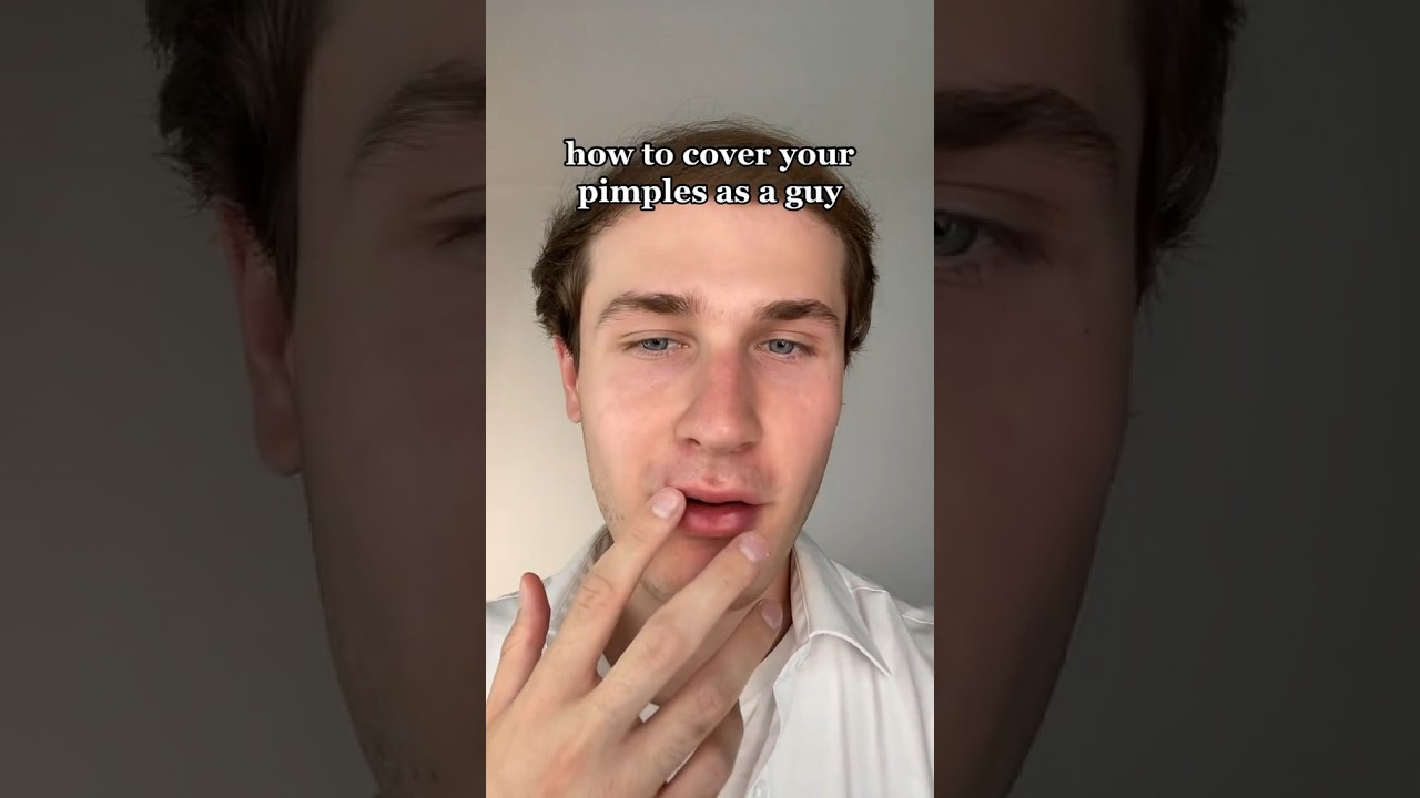 How to Conceal Your Pimples as a Man #shorts