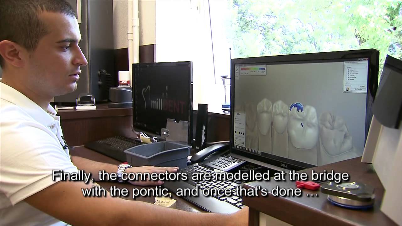 How to create and mill dental prostheses with the DWX-50 from Roland DG.