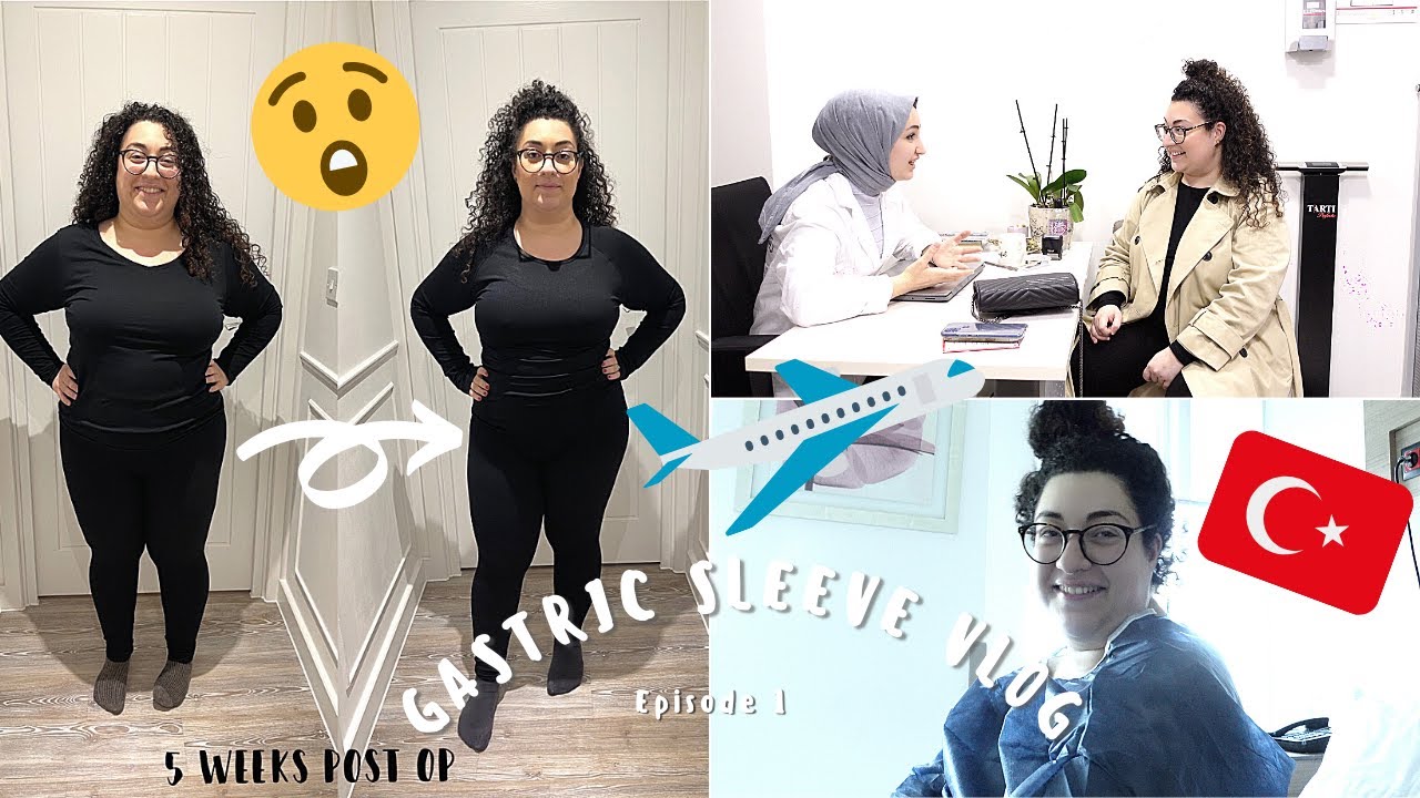 I HAD GASTRIC SLEEVE SURGERY: My surgery experience and 6 weeks post op update