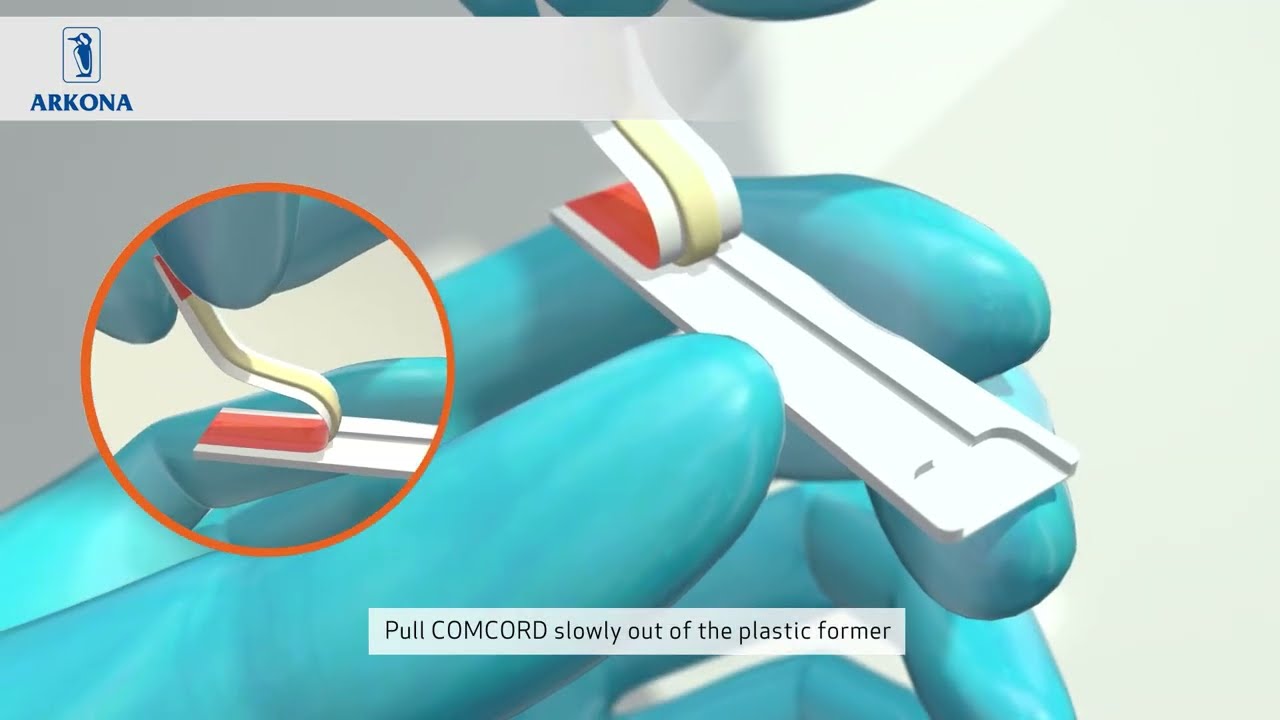 Comcord Fiber – Product Composition and Proper Application in Splinting
