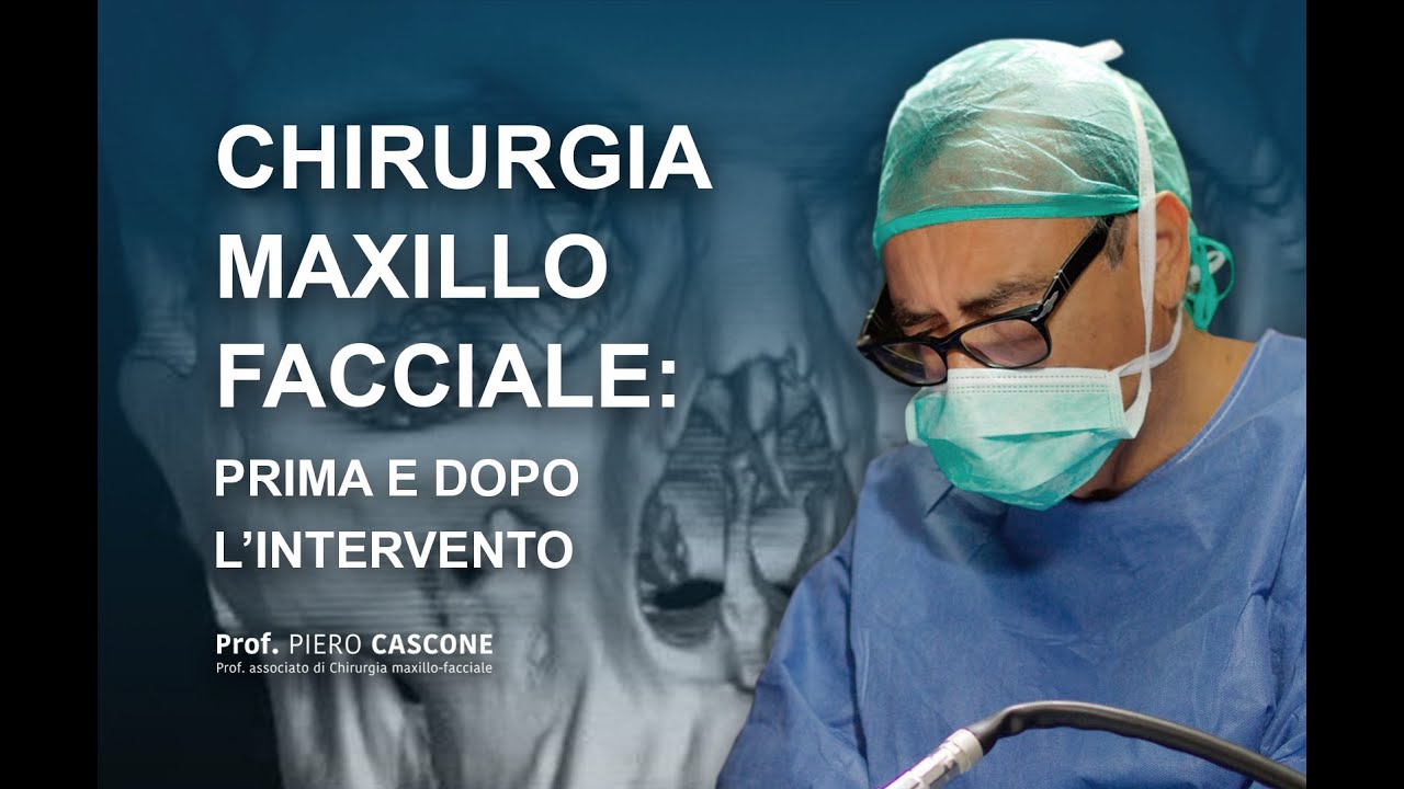 PRIMA E DOPO: intervento ATM Chirurgia Maxillo-facciale