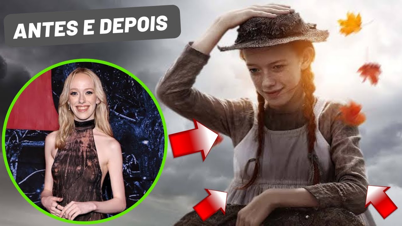 Como estão o elenco de Anne with an E em 2023 / Antes e Depois