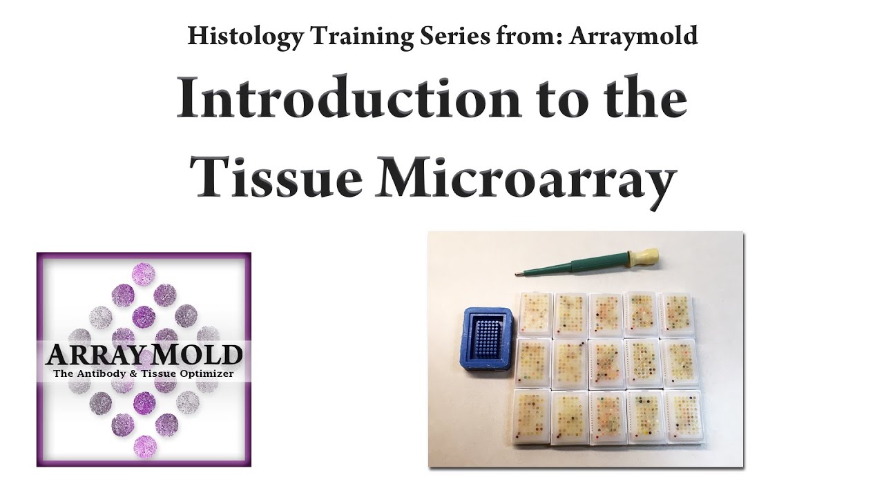 How To Create A Tissue Microarray Block