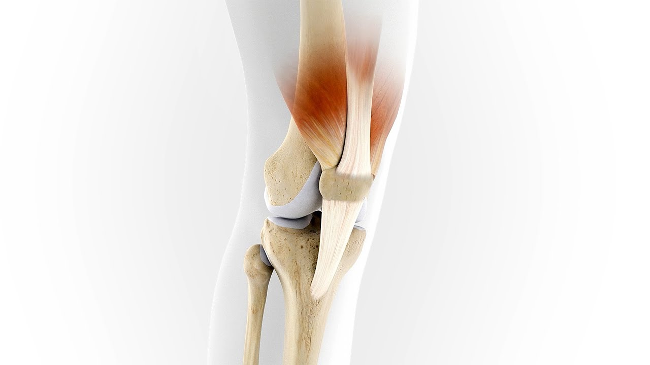 Patella Pro - proper tracking makes all the difference