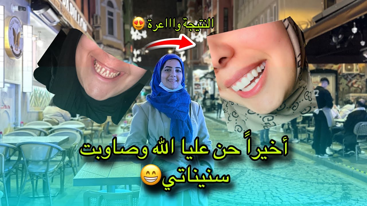 كلشي بالتفاصيل👌🏻بشحال تقامو عليا  ستينات، ؟ و شنو الأخطاء اللي ماخاصكمش ديروهوم باش ماينصبوش عليكوم…
