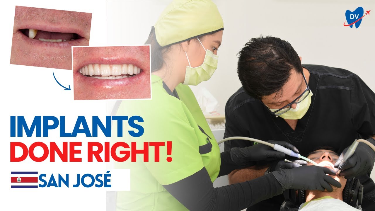 Full Mouth Dental Implants in San José: Costa Rica Dentist Breaks Down Real Cases!