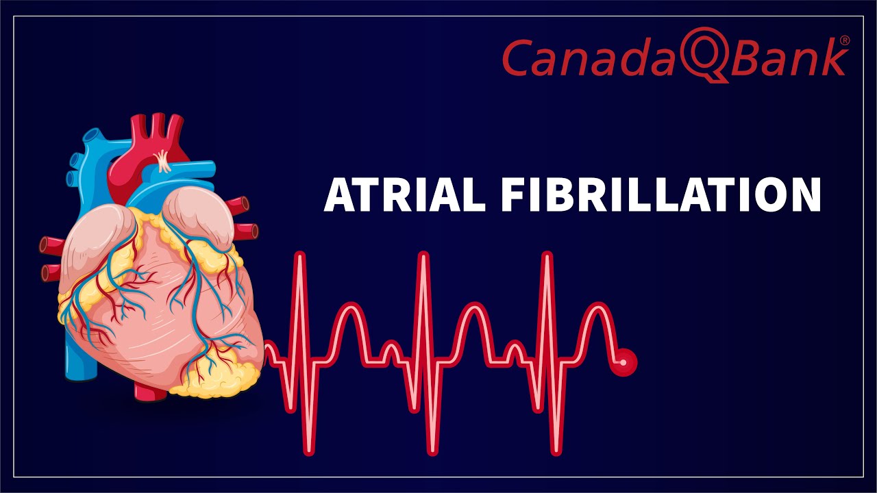 Atrial Fibrillation (AFib): Causes, ECG Findings, Treatment & Stroke Risk | Cardiology | CanadaQBank