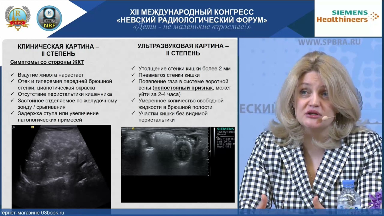 SIEMENS Healthineers Некротизирующий энтероколит. Новые возможности в УЗД.