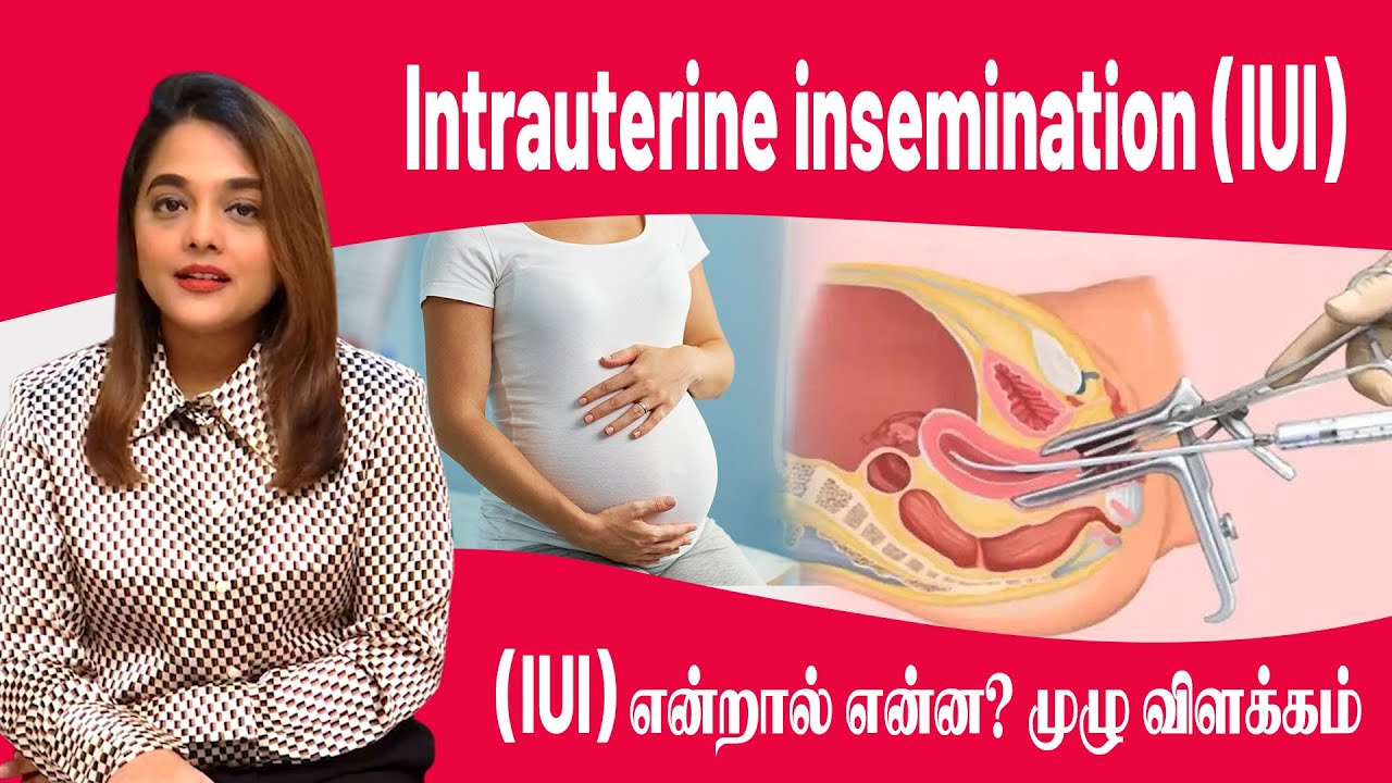 Intrauterine Insemination IUI