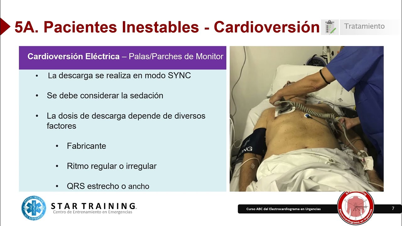 ACLS Tratamiento de Taquiarritmias