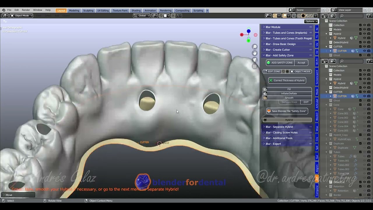 Flujo Digital Blender for Dental: Diseño Simple en Ibar (Barra Inversa) No es Tutorial