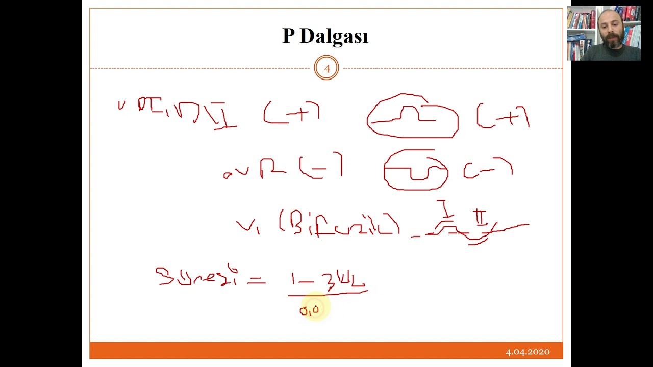 EKG Dalgaları ve Açıklamalar, P Dalgası