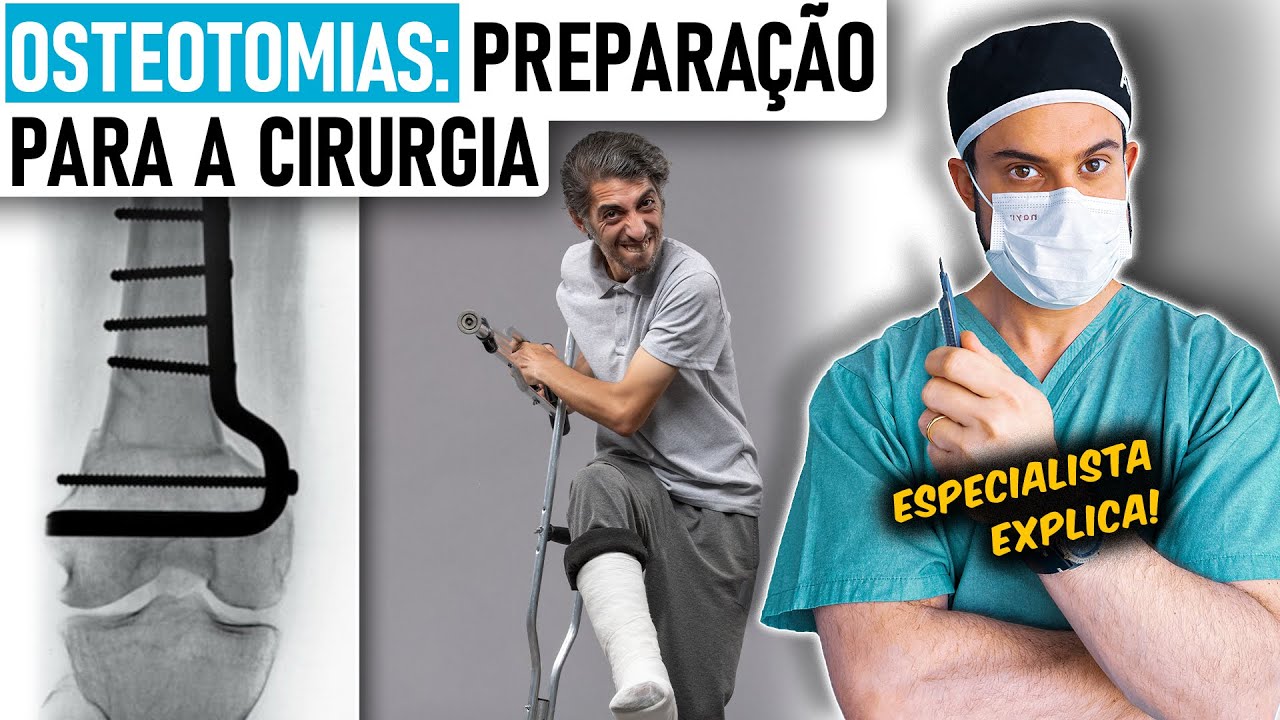 Osteotomias de Joelho: Guia de Recuperação Completo c/ Ortopedista [Pré ao Pós-Cirúrgico]