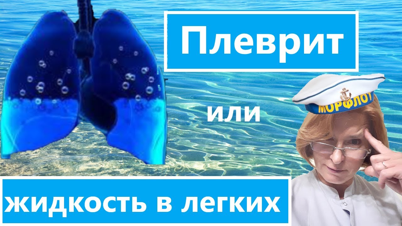 Плеврит