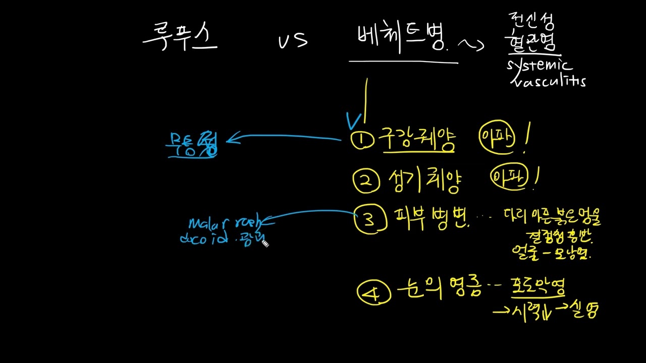 lupus25 - 루푸스 vs 베체트병
