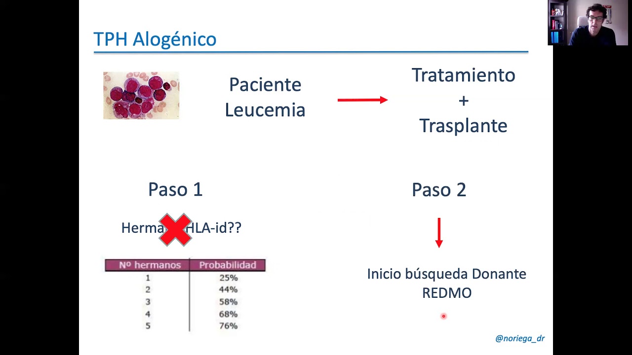 2/3 Trasplante Alogenico de MO, Dr Noriega