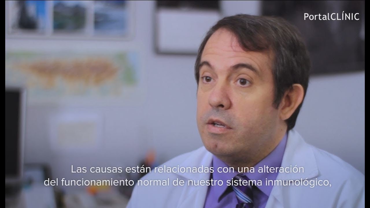 Sjögren Syndrome | PortalCLÍNIC