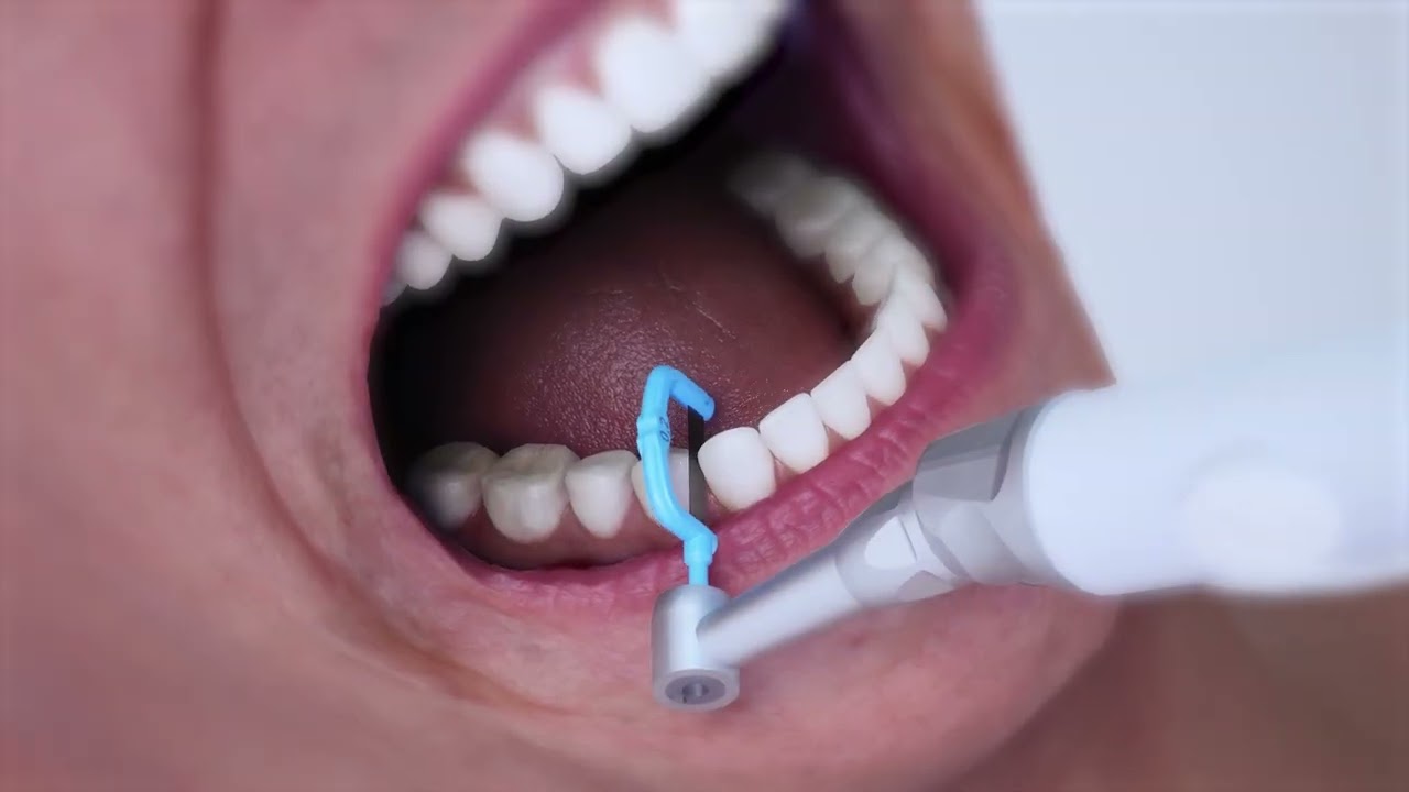 Dal tecnico al memorabile: guarda come il 3D cambia la percezione -  Il caso Dentasonic