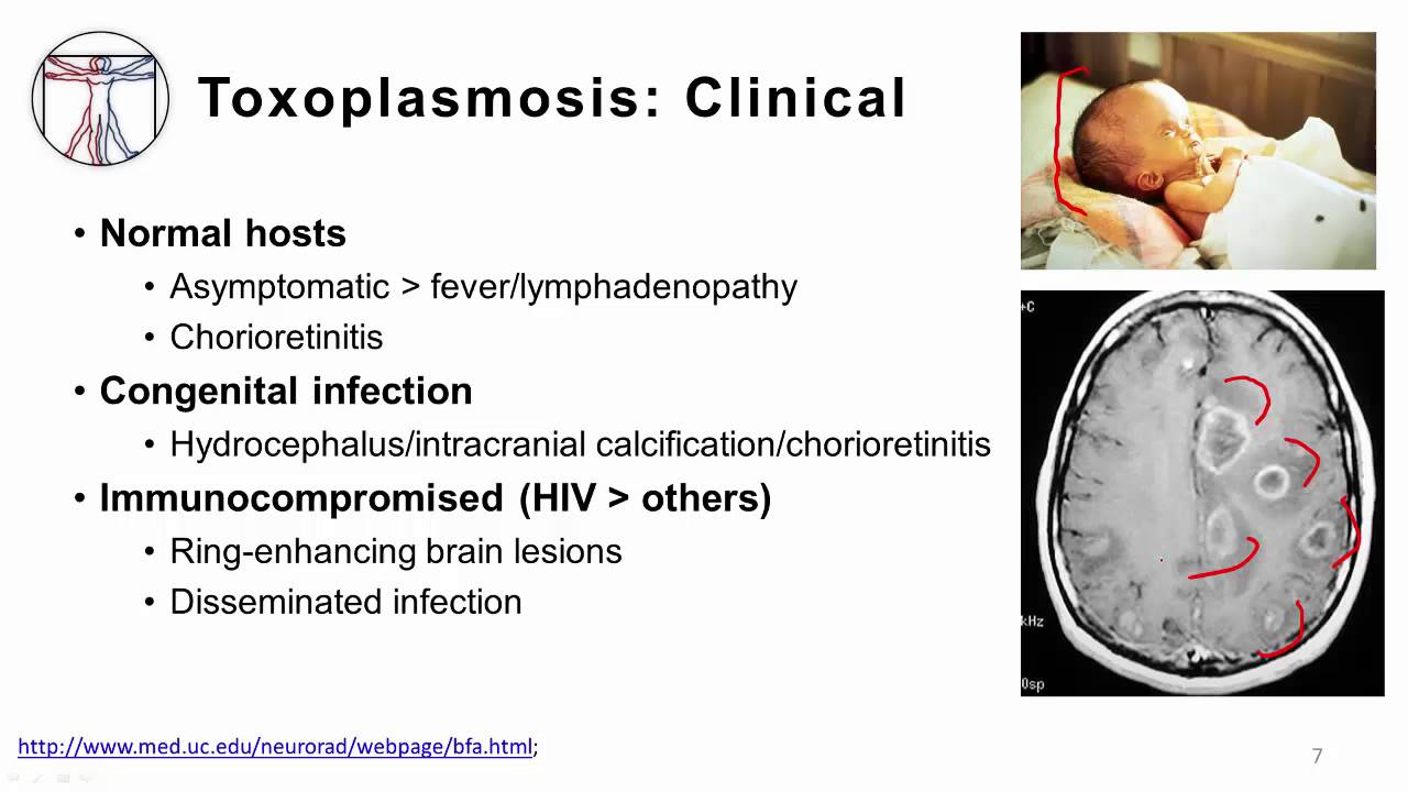 Protozoa: CNS