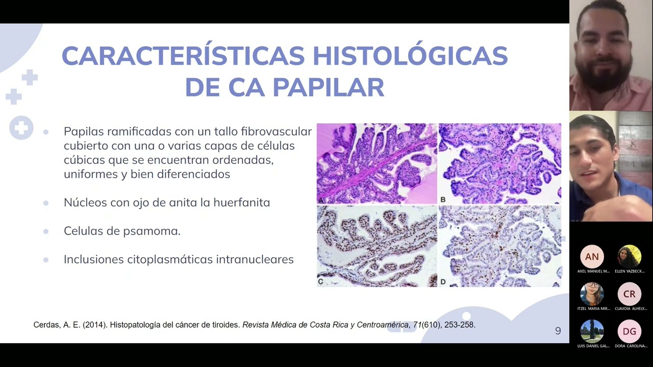 Cáncer de tiroides