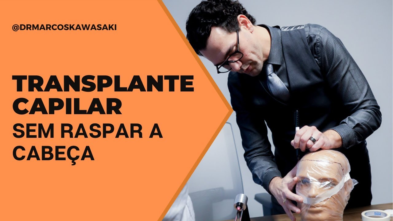 Transplante capilar sem raspar a cabeça: isso é possível?
