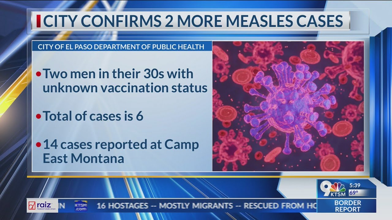 2 more confirmed measles cases in El Paso