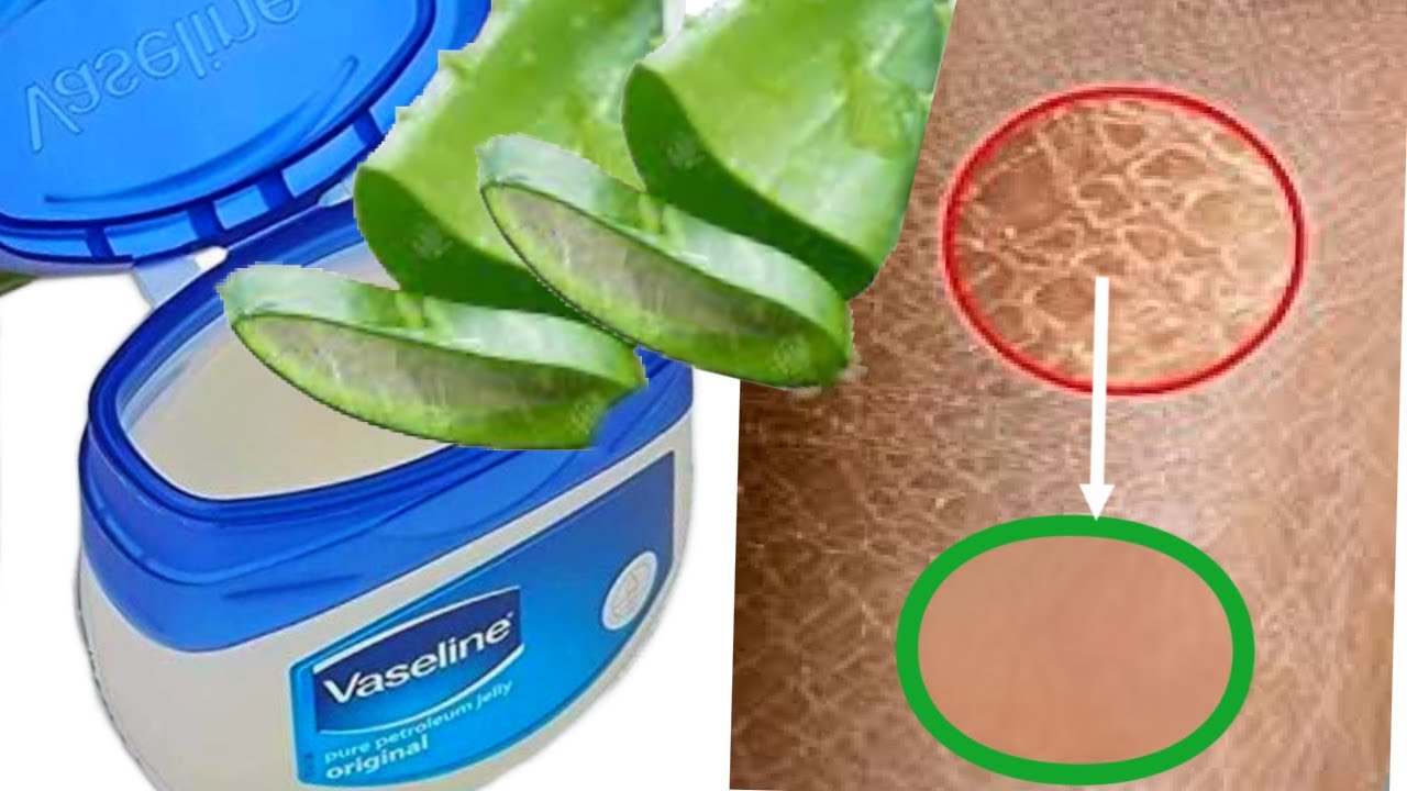Mix Vaseline With Aloe Vera And You Will Be Shocked!
