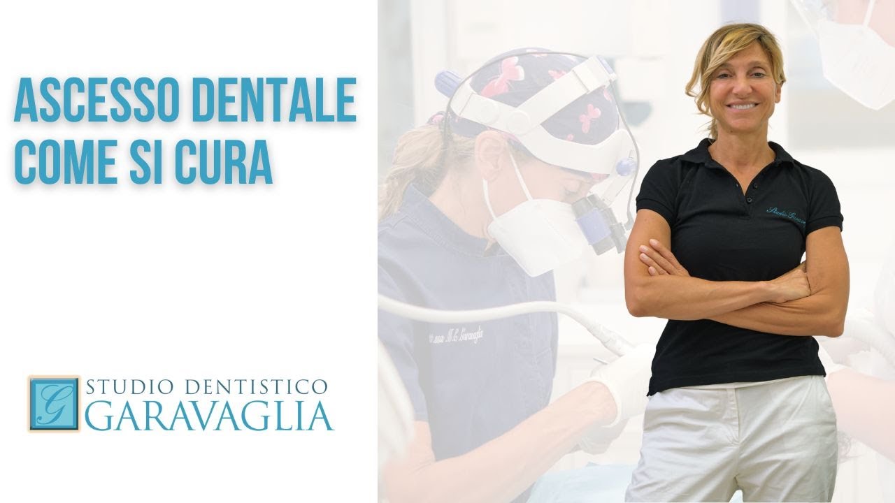 Ascesso dentale come si cura