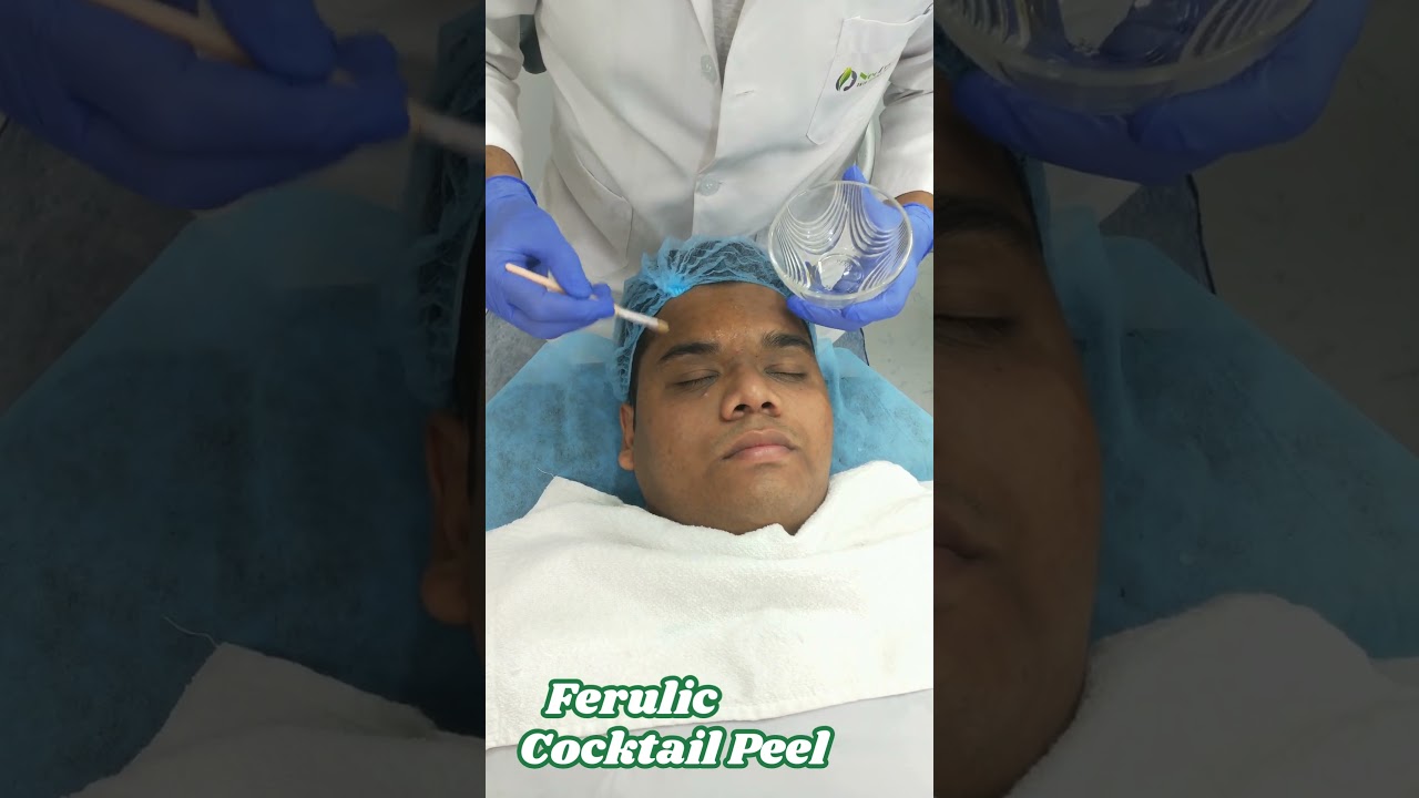 “Ferulic, Glycolic & Kojic Peel Review | Real Results for Melasma & Skin Rejuvenation”