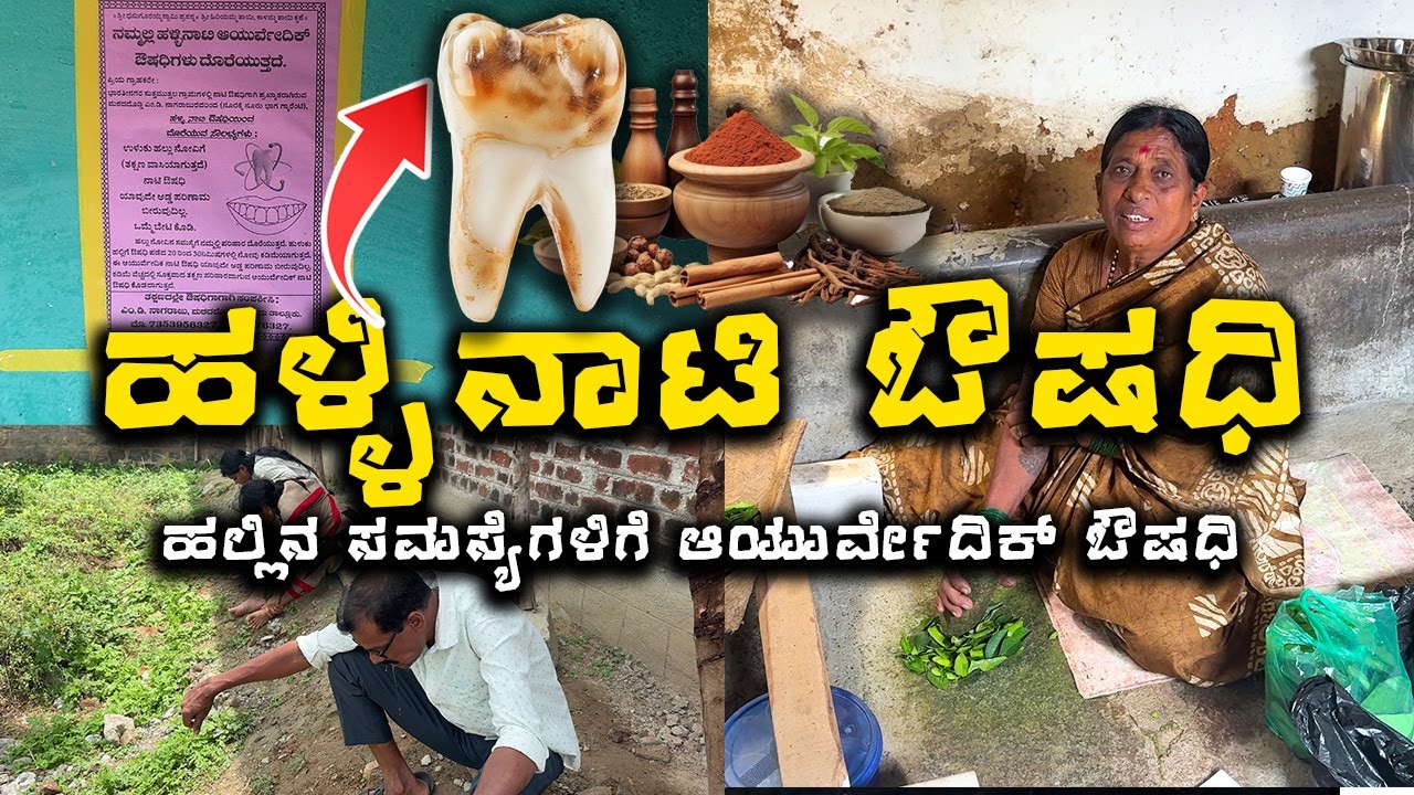 ಹಲ್ಲು ನೋವಿಗೆ ಹಳ್ಳಿನಾಟಿ ಔಷಧಿ 💥 Village Ayurvedic| ನಾಟಿ ವೈದ್ಯಚಿಕಿತ್ಸೆ | #ayurvedic