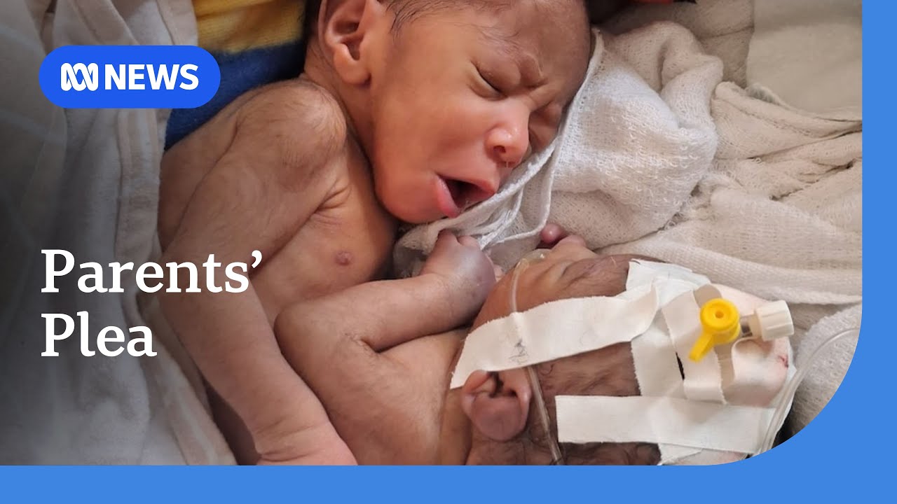 PNG conjoined twins should not be separated due to risk of death, doctors say | ABC NEWS