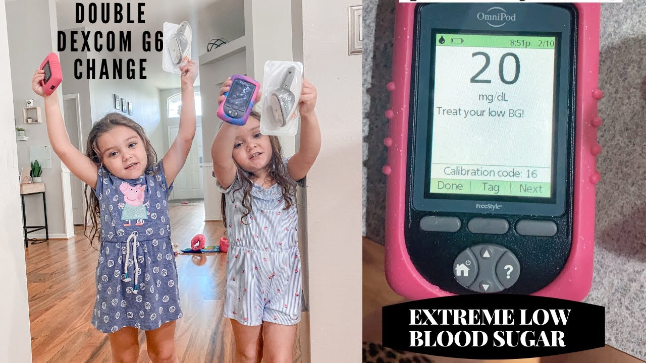 DOUBLE DEXCOM CHANGE | EXTREME SCARY LOW SUGAR