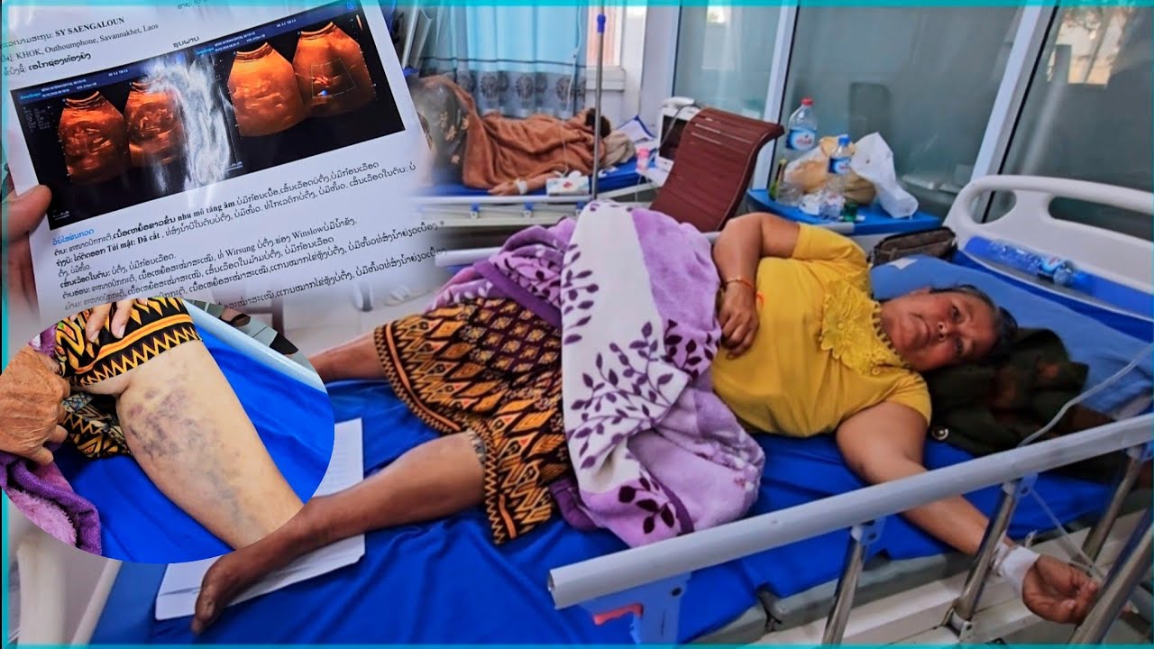 อัพเดทอาการวันที่ 2 แม่บ่าวตูน 6 กุมภาพันธ์ ค.ศ. 2026