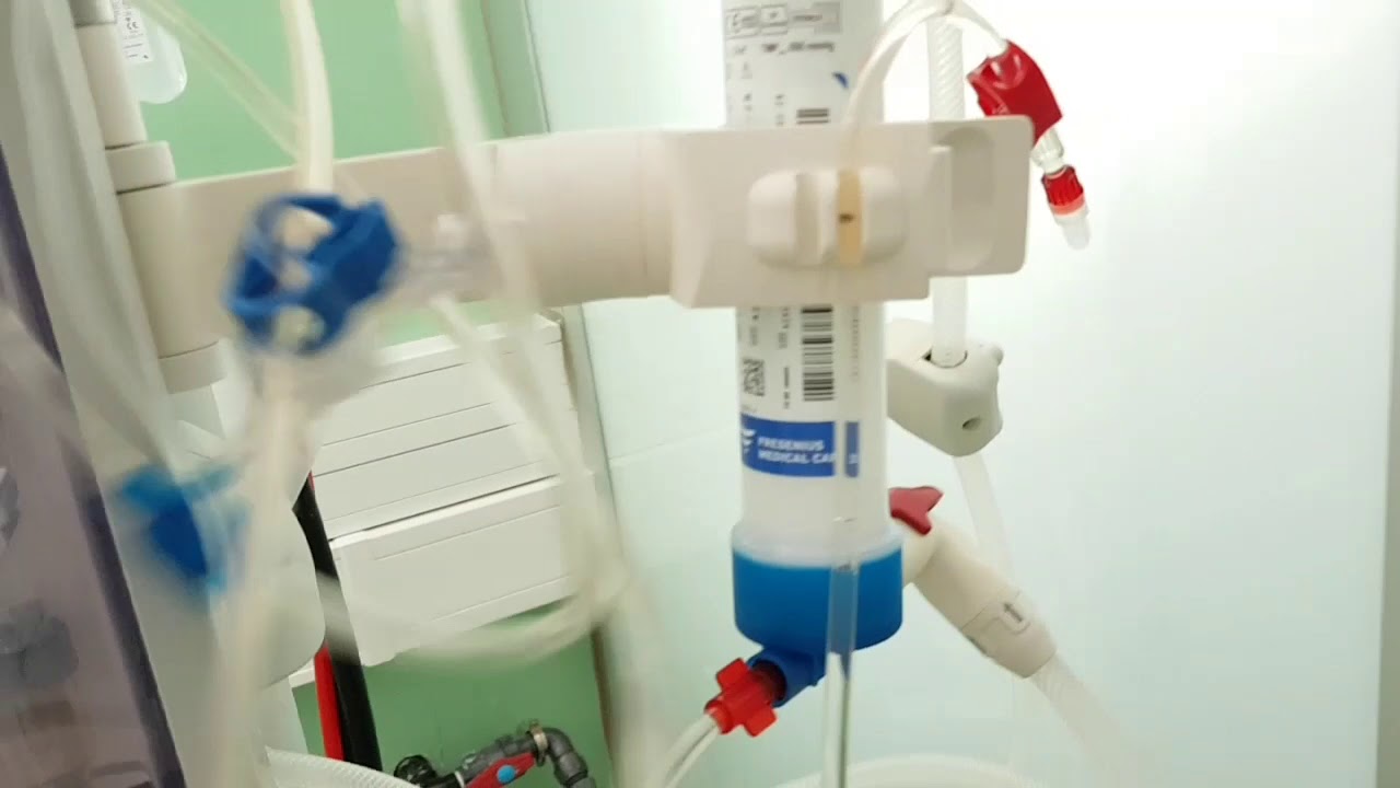 Cebado monitor 5008 Fresenius con NaCl y conexión simultánea FAVI-CDL