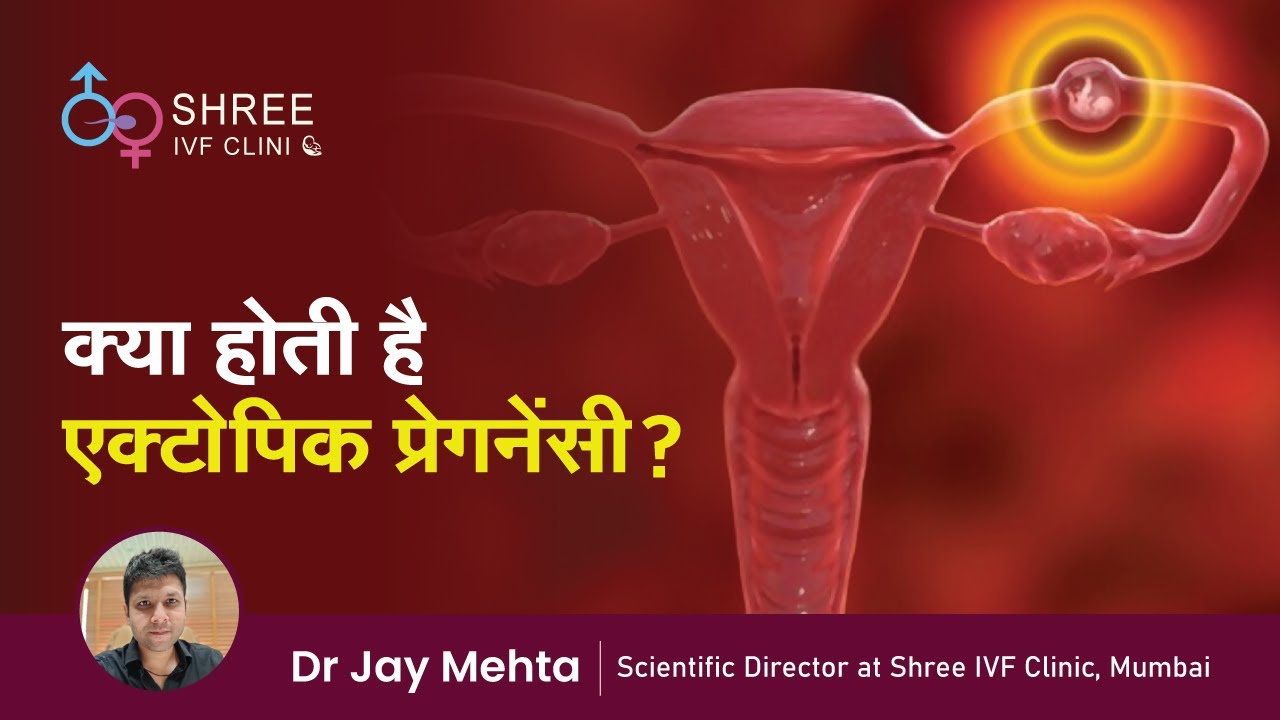 क्या होती है एक्टोपिक प्रेगनेंसी? | Ectopic Pregnancy (Hindi) | tube me baby hone ke lakshan |Dr Jay