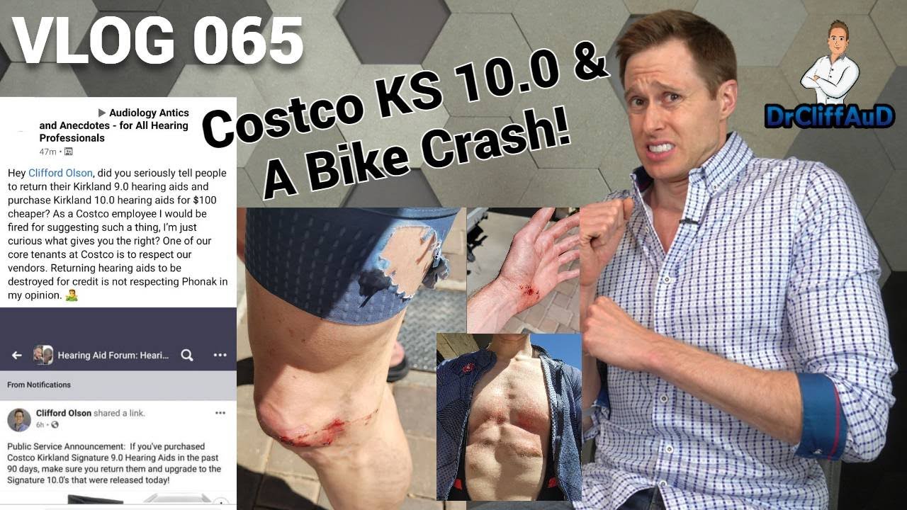 New Costco Kirkland Signature 10.0 Hearing Aid & My Cycling Accident! | DrCliffAUD VLOG 065