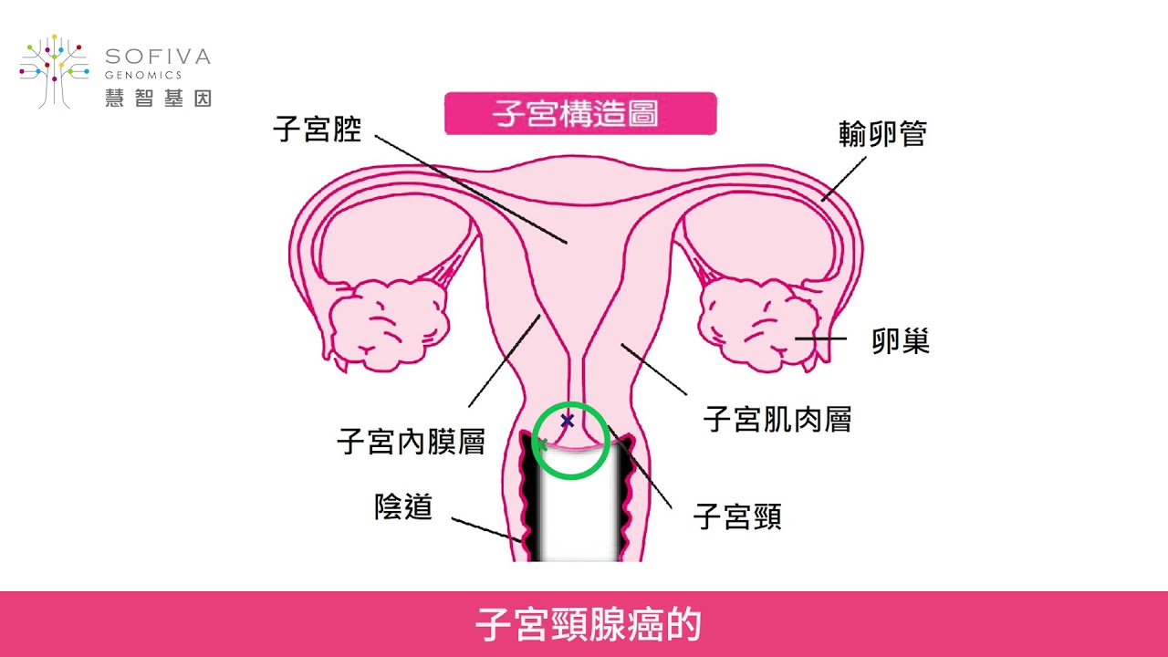 【健康馨生活 醫師來開講】一起來認識子宮頸抹片檢查