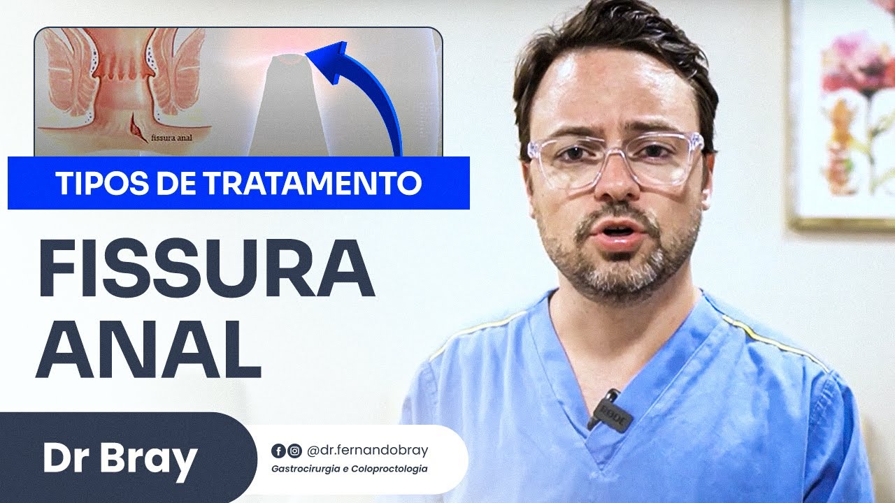 Fissura Anal - Conhe&ccedil;a os tipos de tratamento