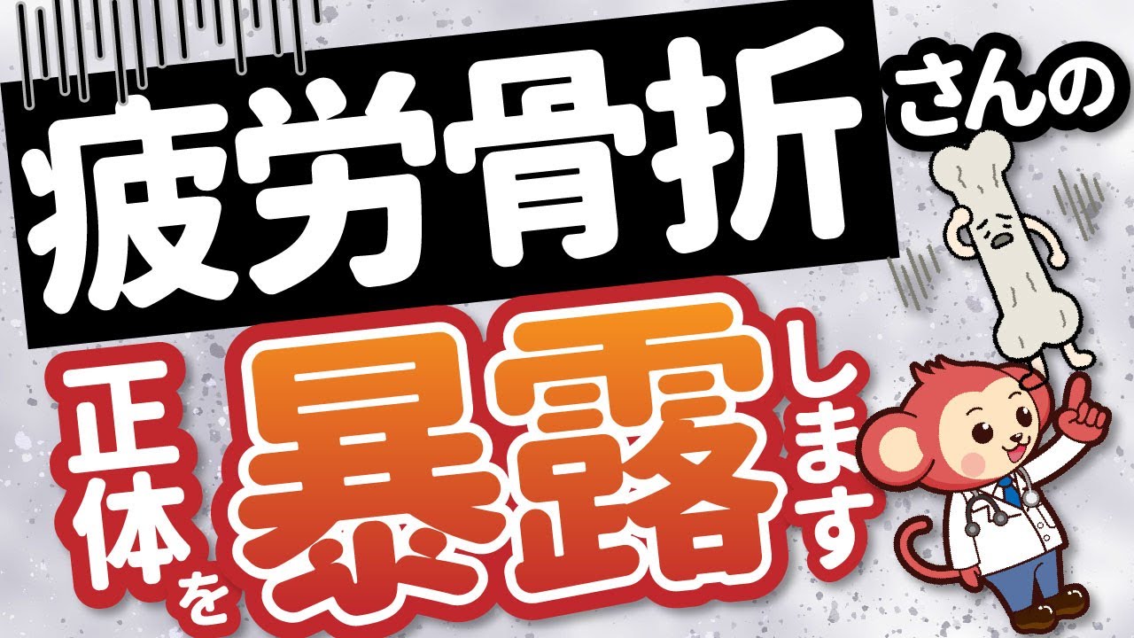 疲労骨折はなぜ起こる？原因と治療法を現役整形外科医監修アニメーションで解説