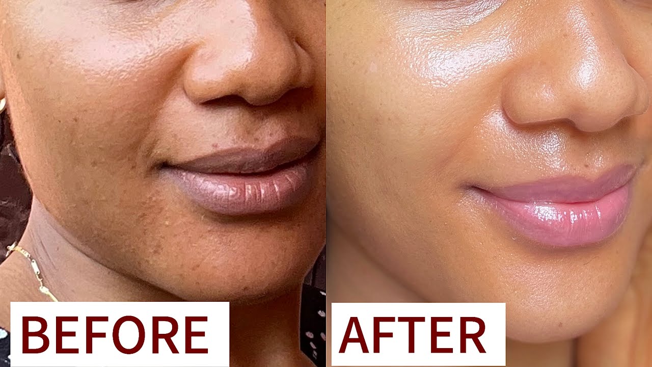 THIS IS WHY YOUR FACE ISN’T SMOOTH/ HOW TO GET RID OF TEXTURED SKIN.rough skin #glowyskin #clearskin