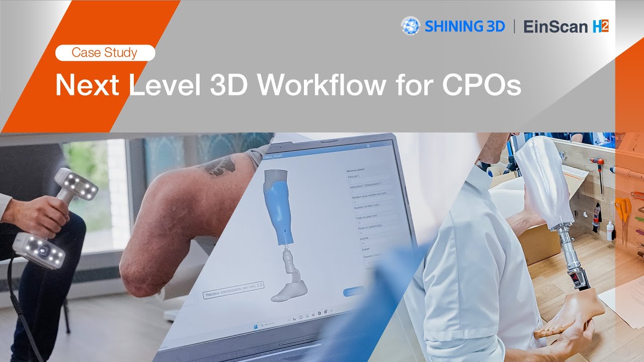 From 3D Scan to 3D Printed Prosthesis I EinScan H2
