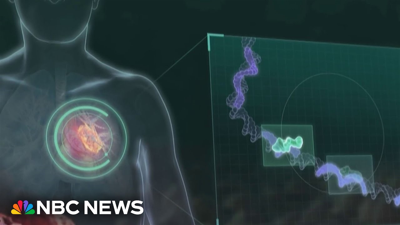 Merck and Moderna say cancer vaccine shows signs of preventing recurrence of melanoma
