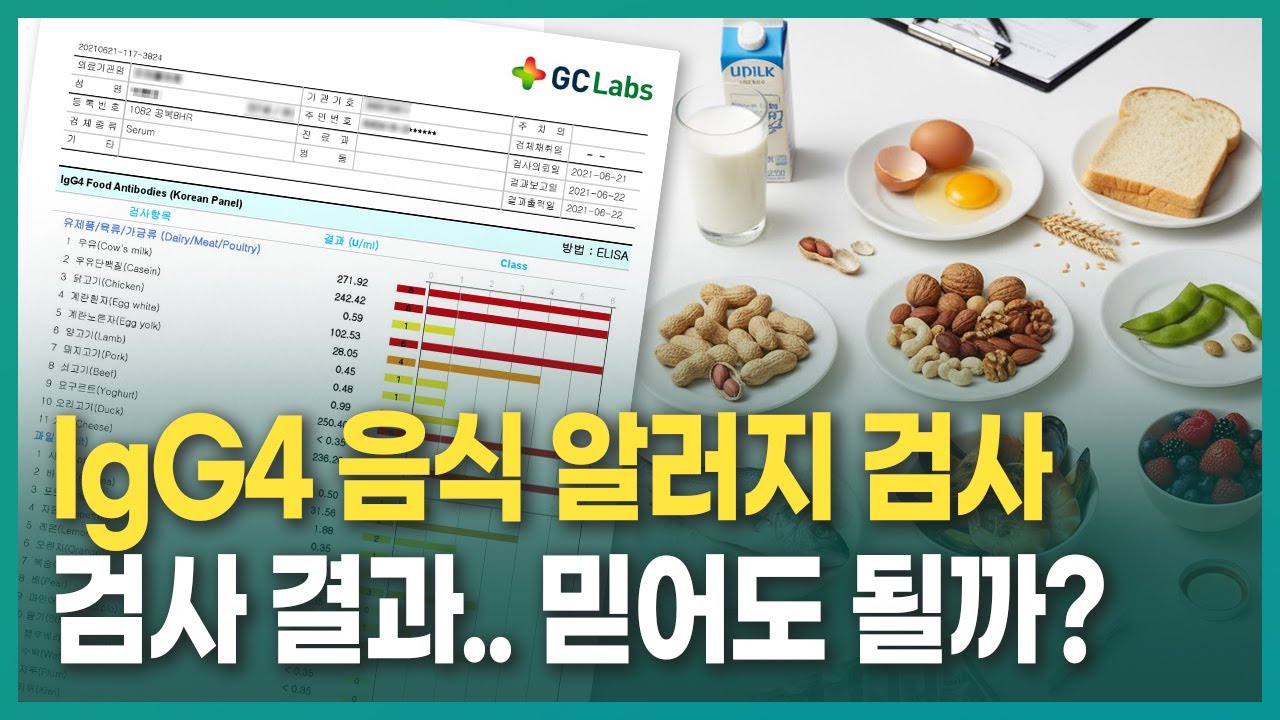 IgG4 음식 알러지 검사, 결과 믿어도 될까?