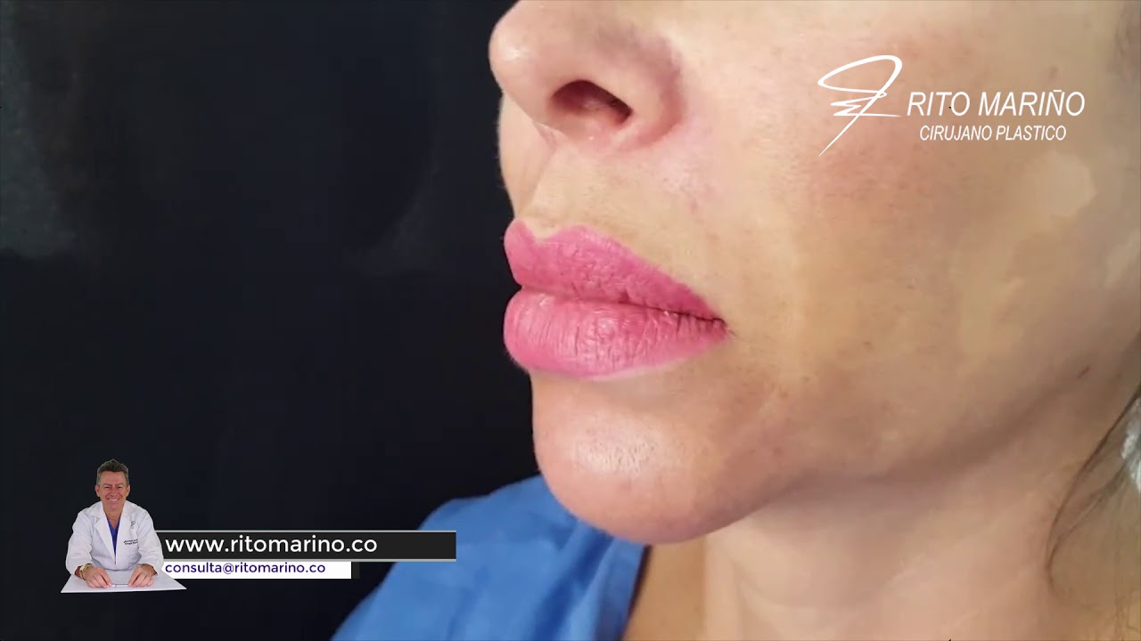 Extraccion de Biopolimeros en Labios