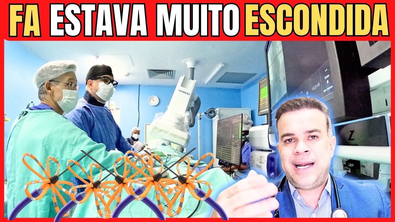 ABLAÇAO DE FIBRILAÇÃO ATRIAL COM CAMPO PULSADO com Dr.  FELIPE SOUZA - refazendo uma ablação prévia