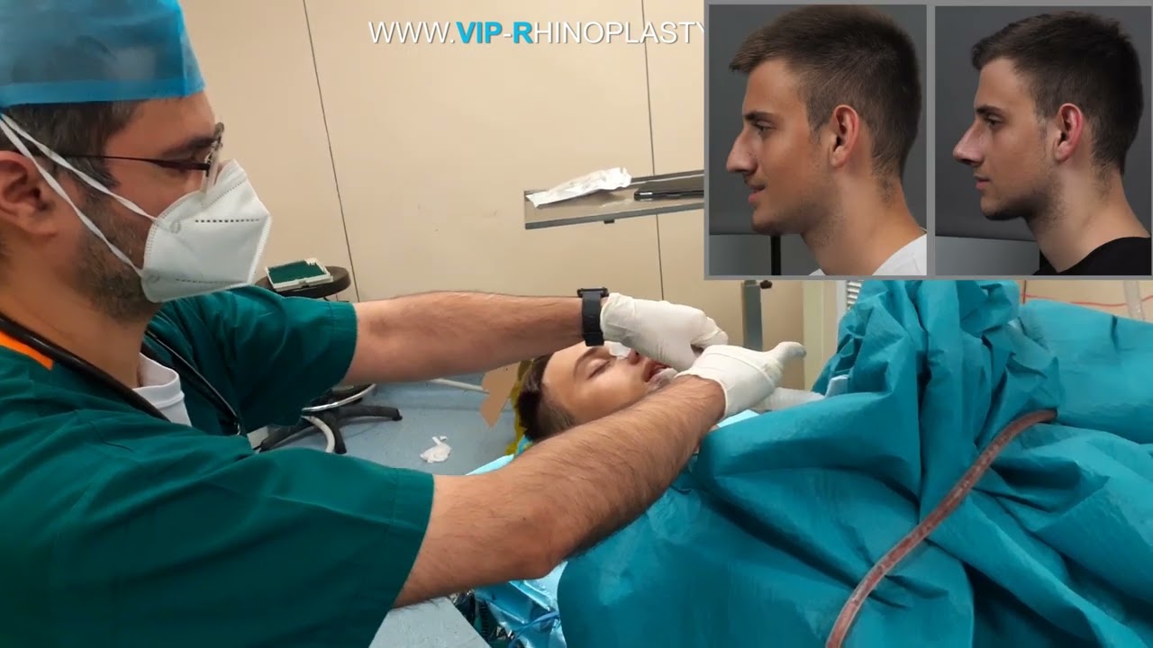 Surgery Day |Full General Anesthesia & Waking Up inside surgery room | Intubation | Sleep & Recovery