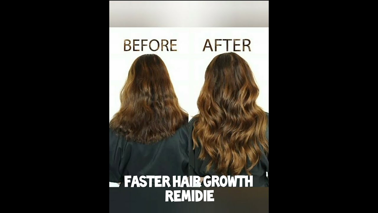 Hair growth homemade remidie | Beauteous