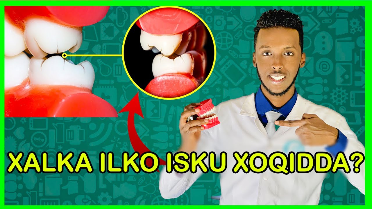 ILKO JIRIRQSIGA🦷 IYO SIDA LA ISAGA JOOJIYO | BRUXISM