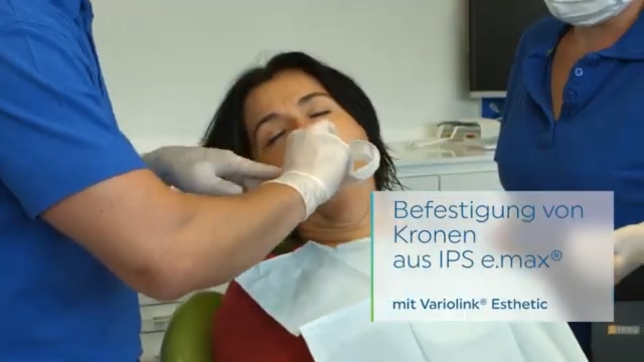 Variolink® Esthetic - Befestigung von Kronen aus IPS e.max® | DE | Ivoclar