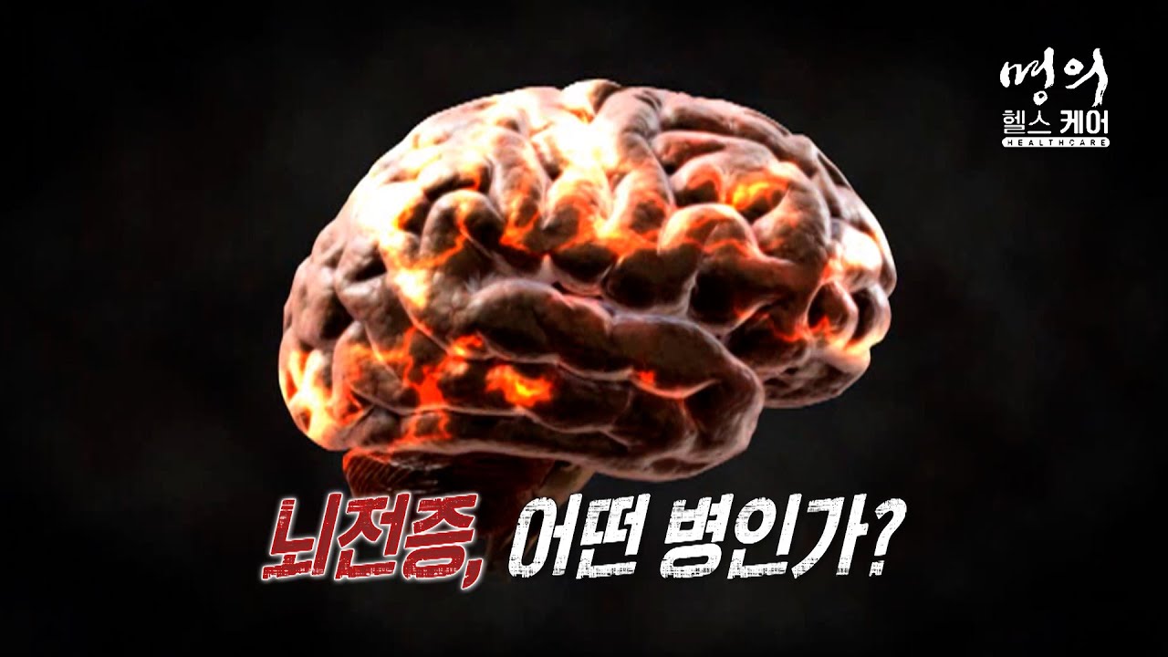 명의 헬스케어 - 뇌전증, 어떤 병인가?